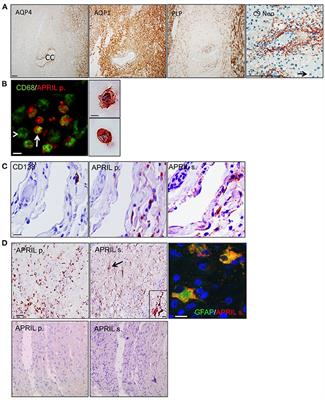 Case Report: In Situ Expression of a Proliferation-Inducing Ligand in Neuromyelitis Optica